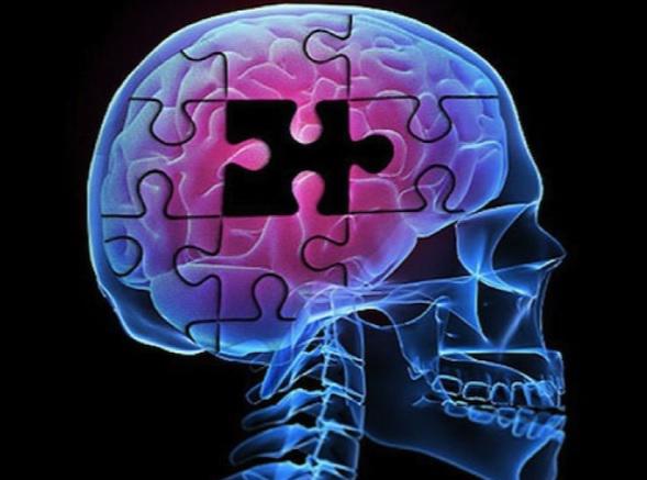 Cum se degenereaza neuronii in urma leziunilor traumatice craniocerebrale, Foto: captura ecran